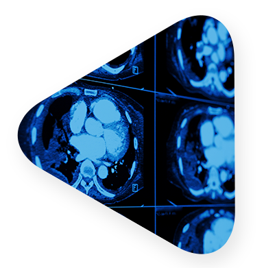 digital imagery of patient brain.