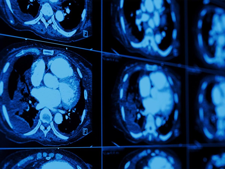 Brain scans