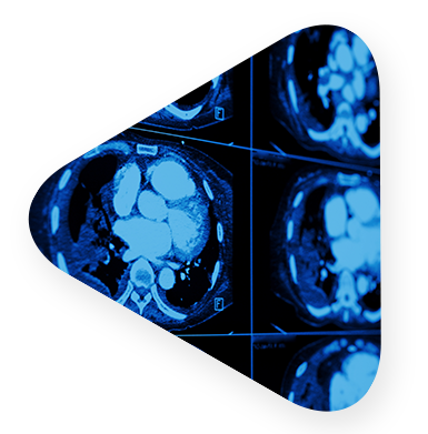 digital imagery of patient brain. 