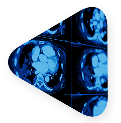 digital imagery of patient brain.